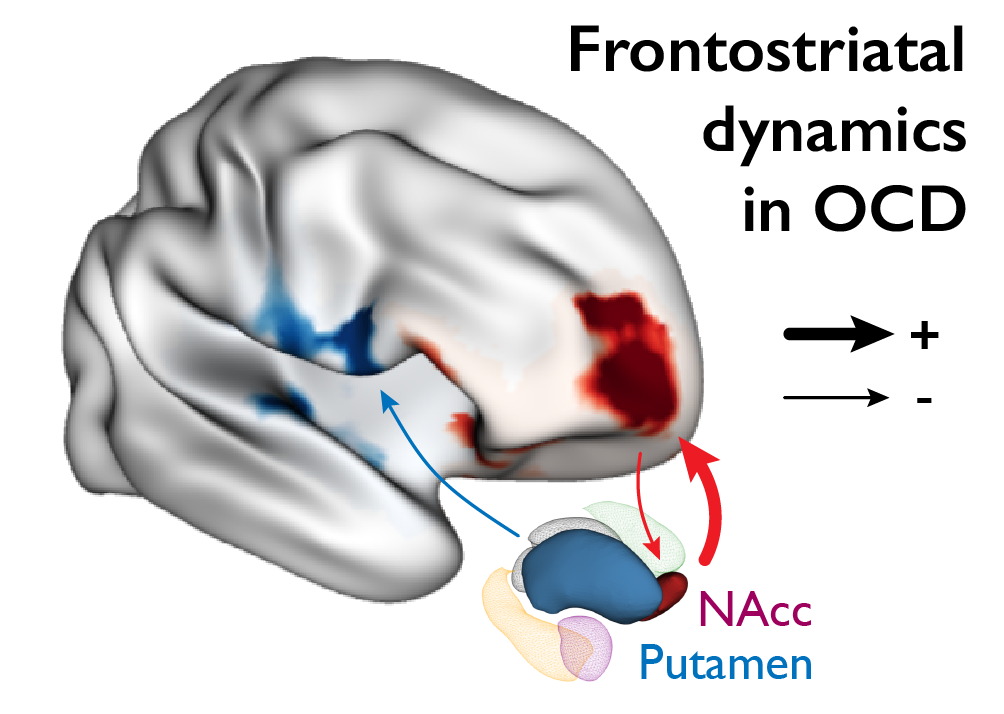 Fronto-striatal imbalance in OCD