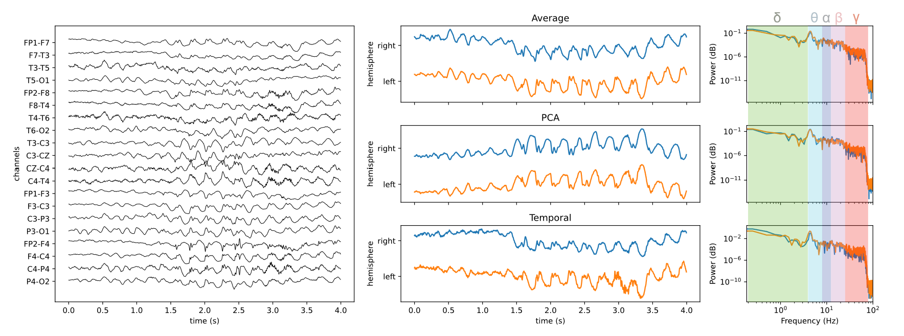 Seizure classification